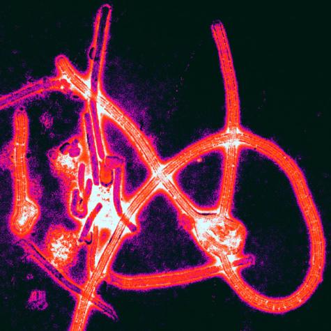 This photo shows the actual make-up of the Ebola virus. Photo by Thomas W Geisbert Boston University School of Medicine via wikimedia. 