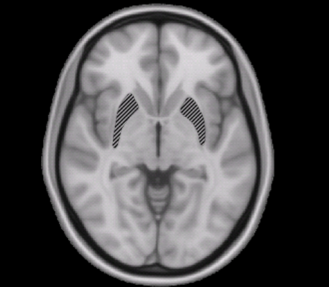 The brain, which is the main causes mental diseases Photo Woutergroen