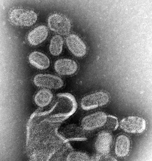 Flu virus. By Photo Credit: Cynthia Goldsmith Content Providers(s): CDC/ Dr. Terrence Tumpey [Public domain], via Wikimedia Commons